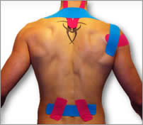 Kinesio Tape on upper body