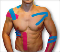 Kinesio Tape on upper body